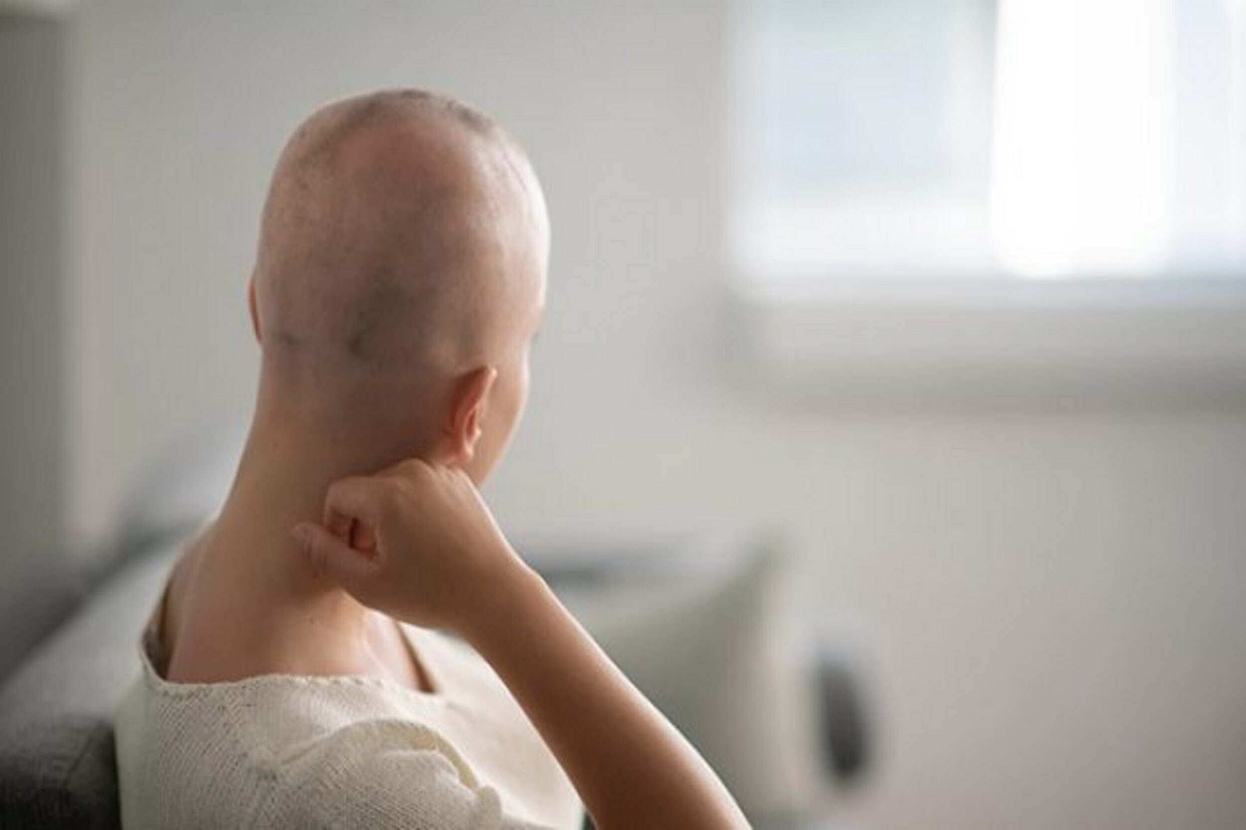 Natural Ways to Prevent Hair Loss from Chemotherapy and Radiation Treatments.